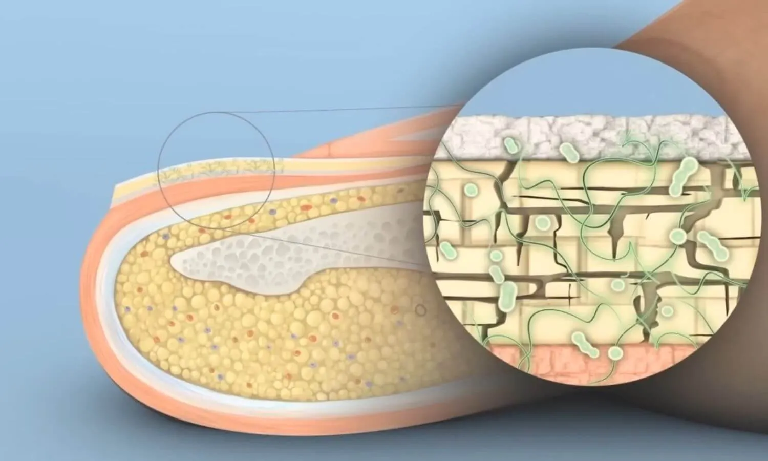 Fungus diagram showing the process
